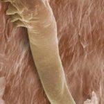 Demodex